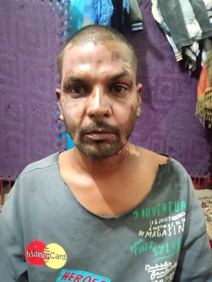 Muslim in Pakistan sets Christian on fire over petty dispute