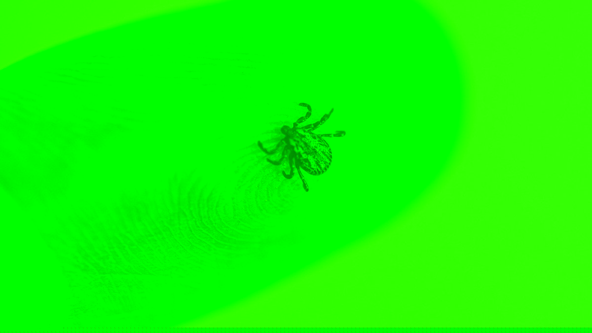 Tick bite symptoms: What to watch for in the days after a bite