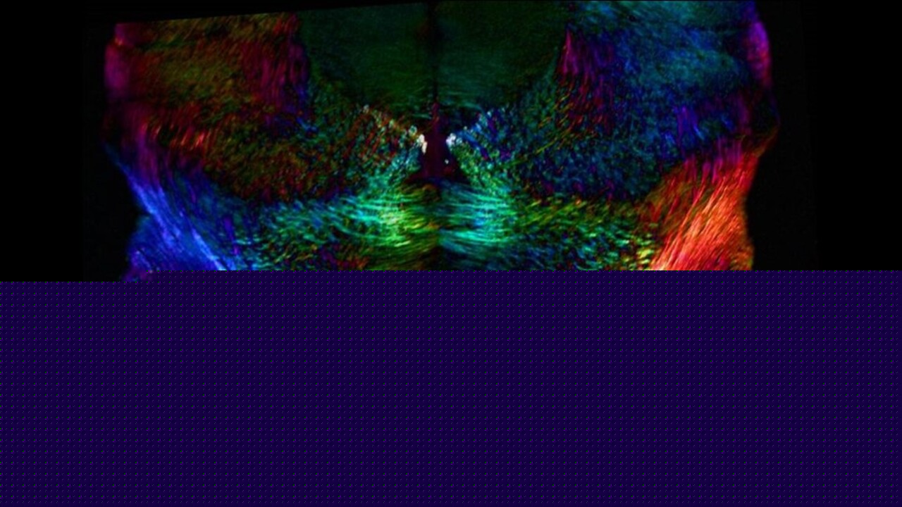 Lo stress vissuto nell'infanzia lascia cicatrici nel cervello