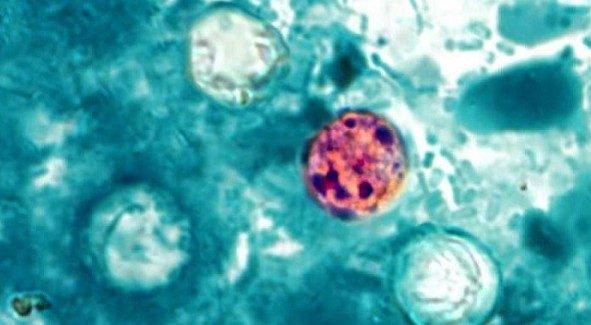 State health department: cyclosporiasis slowing down in Michigan