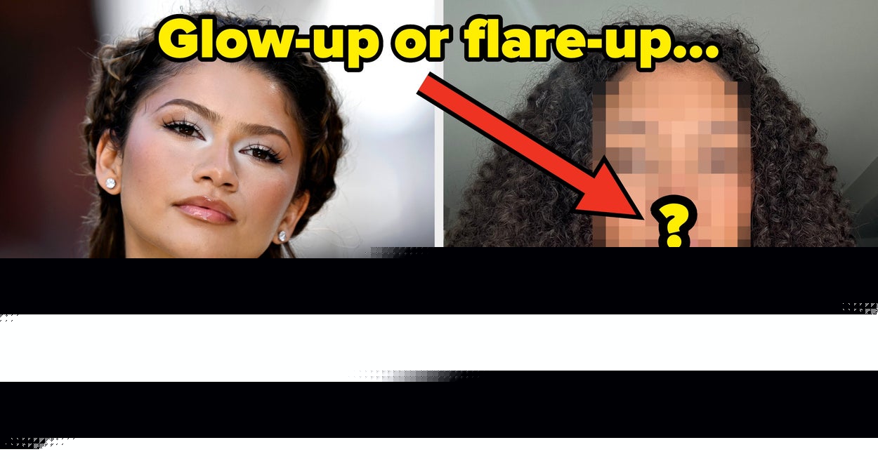 As Someone With Sensitive Skin, I Tried The Charlotte Tilbury Moisturizer That Zendaya Used At “The Odyssey” Premiere To See How It Works