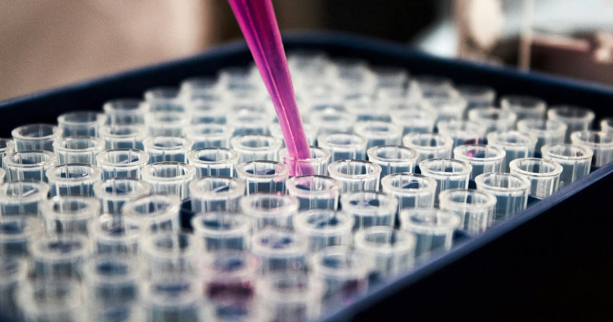 Cancer May Help To Protect Us From Dementia