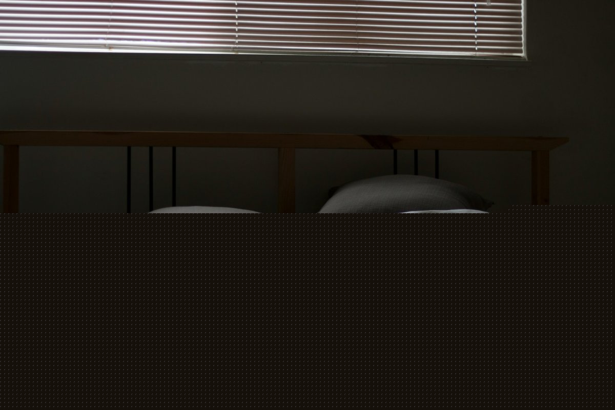 レム睡眠行動障害からパーキンソン病へ進むのか？　被ばくのないMRIで高リスク患者を選別できる可能性