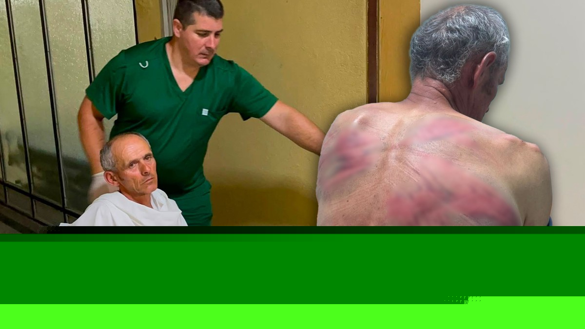 (UZNEMIRUJUĆE FOTOGRAFIJE) "U ŠOK SOBI JE, TEŠKO POVREĐEN!" Najnoviji detalji o stanju Srbina kog je mučki pretukla tzv. kosovska policija: Oglasili se rano jutros iz bolnice