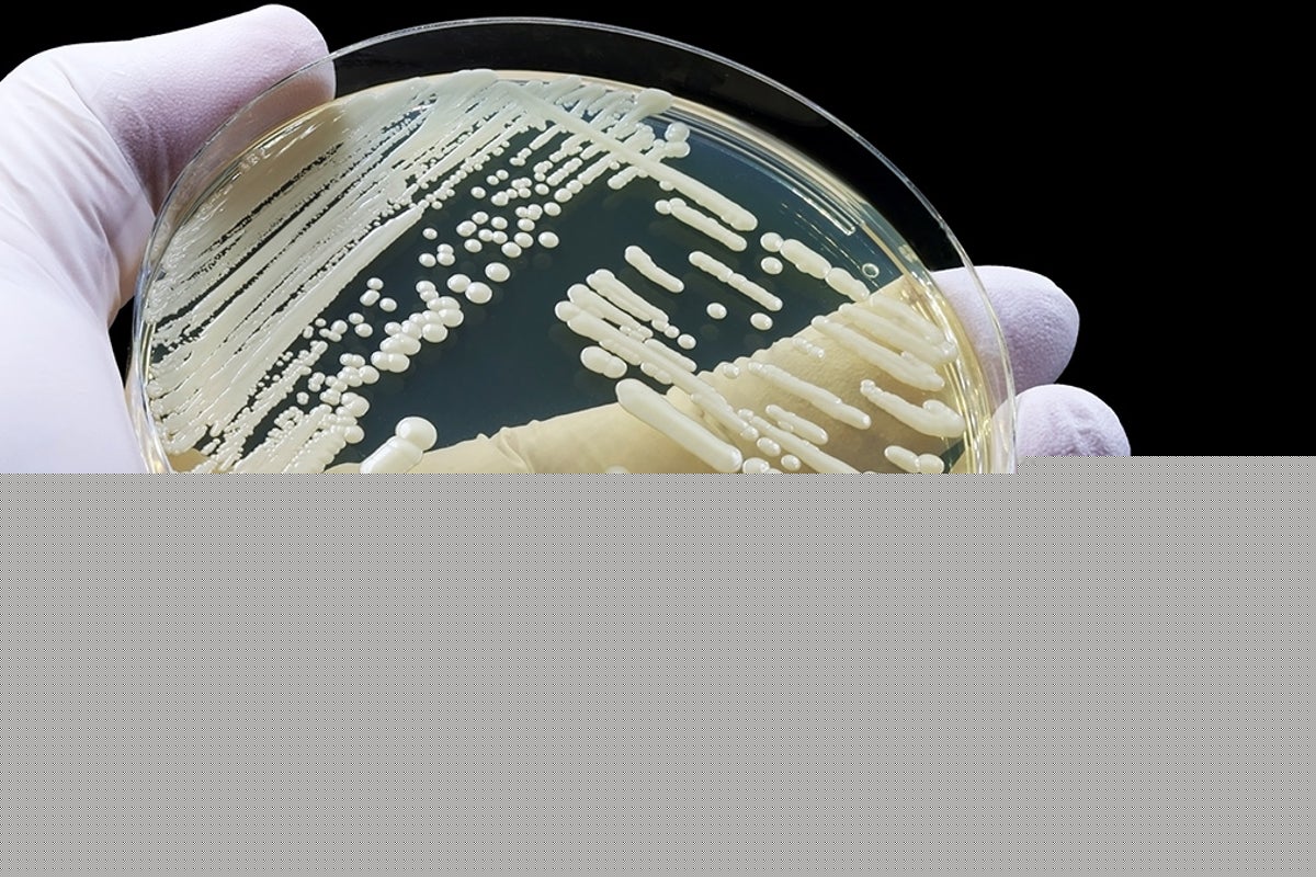 What to know about deadly ‘superbug’ fungus spreading across US