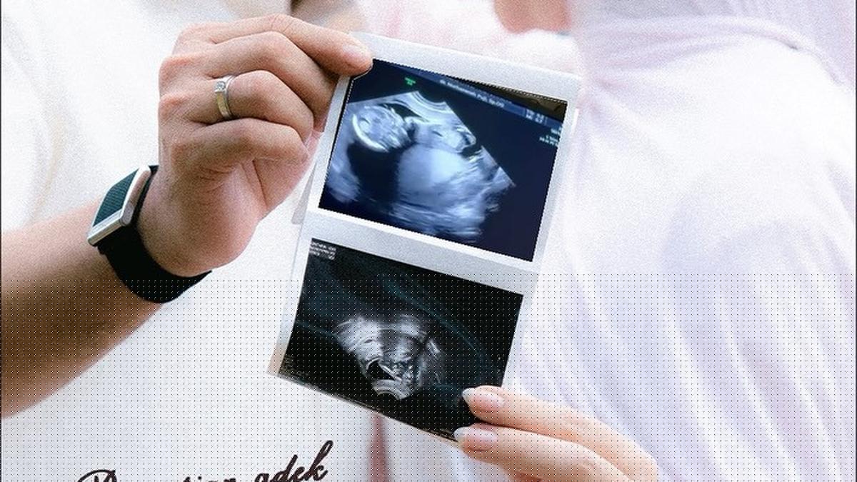 Potret Irish Bella Bagikan Maternity Shoot Bareng Haldy Sabri, Tunjukkan Hasil USG