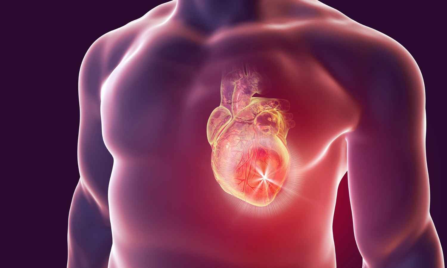 High BMI, High Blood Sugar Drive Rising Burden of Ischemic Heart Disease Deaths in US: JAMA