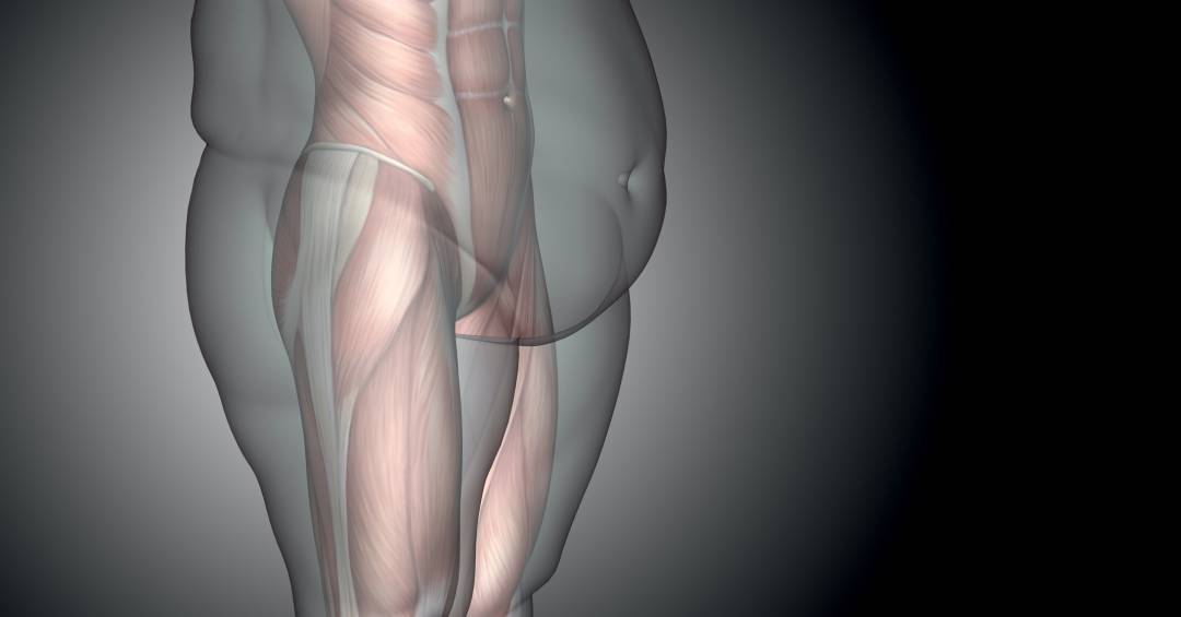 Obesidade está ligada a mais de 1 em cada 10 casos de câncer, diz estudo