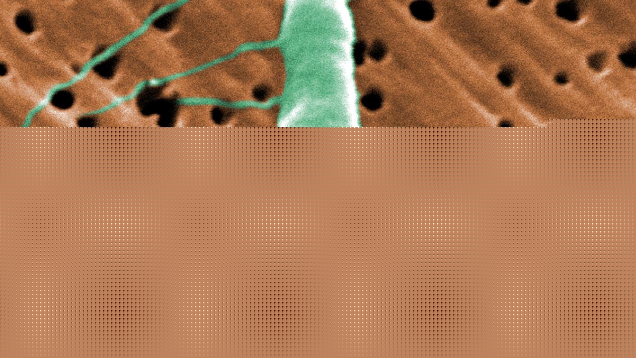Flesh-eating bacteria: Risks, symptoms, and prevention