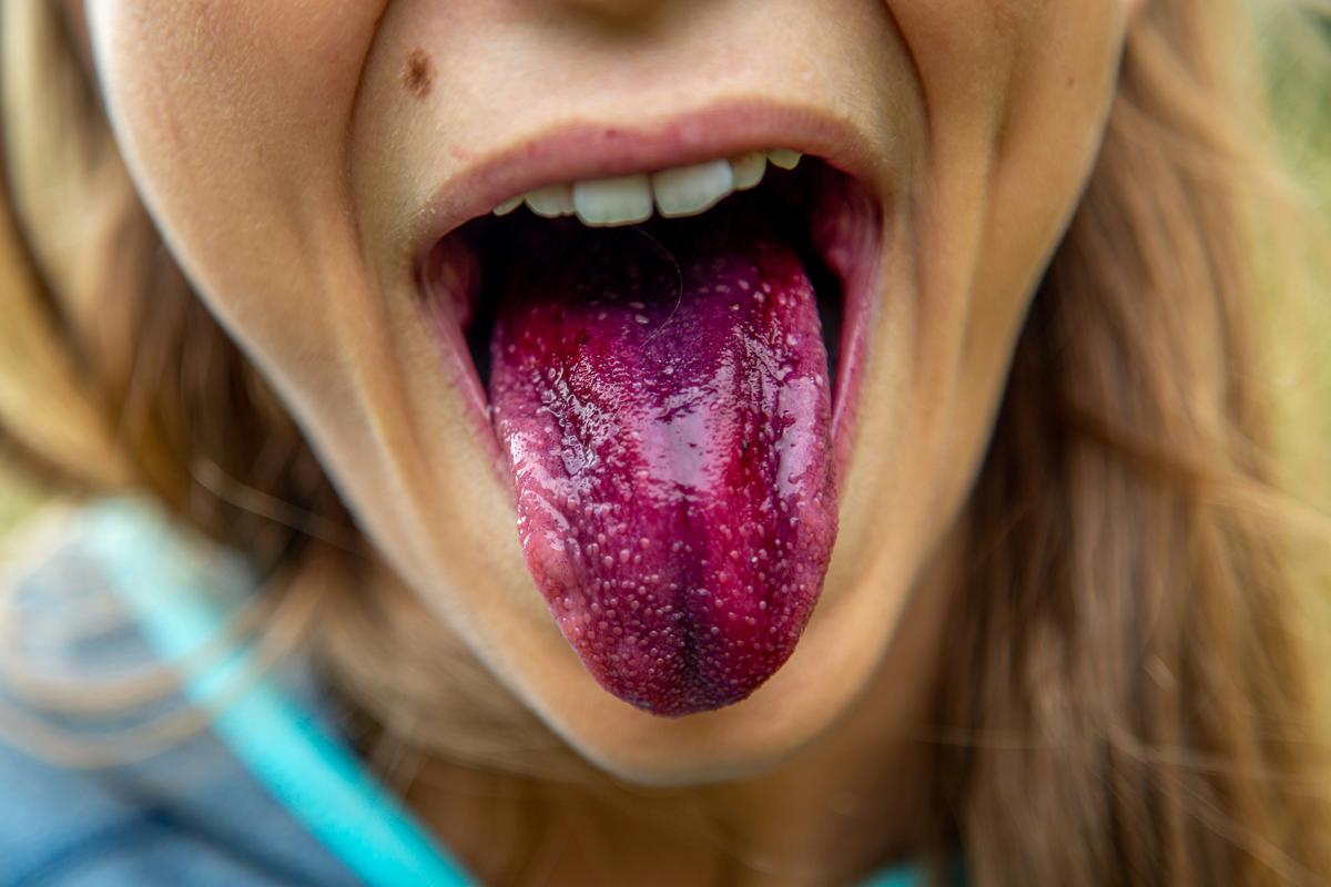 Woman Charged With Biting Off Portion of Her Ex’s Tongue