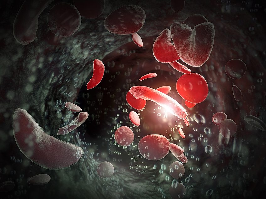 Agios’ phase II tebapivat splats in SCD, Pyrukynd top of mind