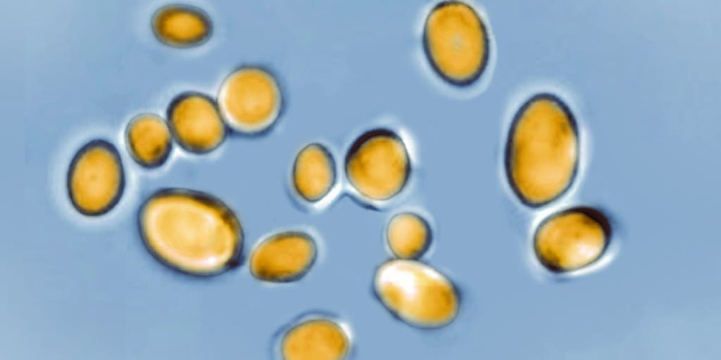 Potentially life-threatening fungus rapidly spreading across the US with limited treatment options