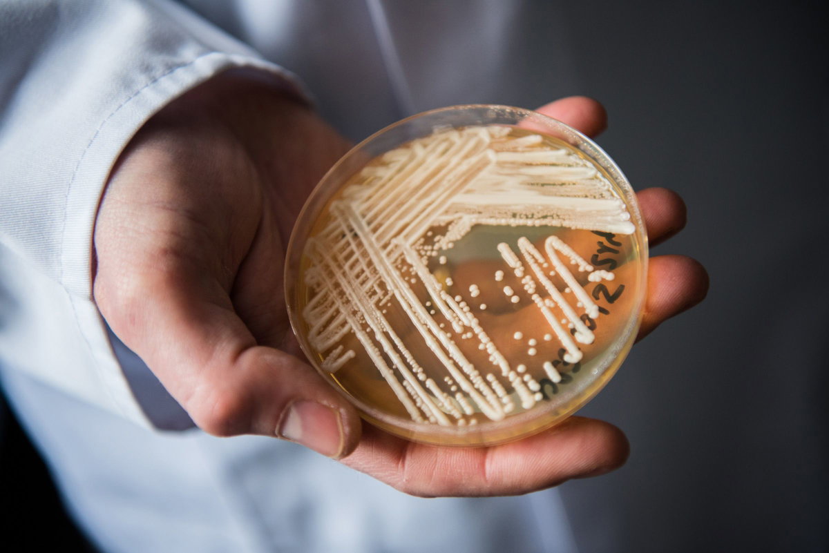 What to know about Candida auris, a fungus contaminating healthcare spaces