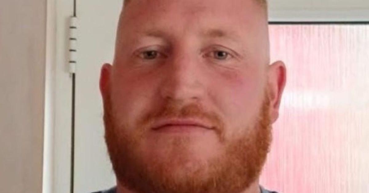 'Violent' man bit girlfriend's face in first of two attacks in as many months
