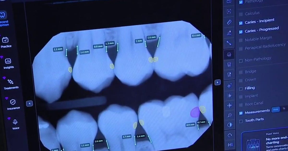 How AI in dentistry is transforming smiles