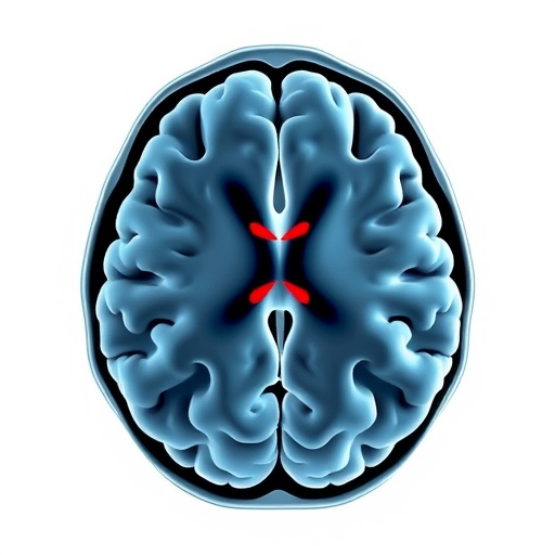 NRG Oncology Trial Reveals Enhanced Survival in Glioblastoma Patients Treated with Proton Therapy, Advances to Phase III