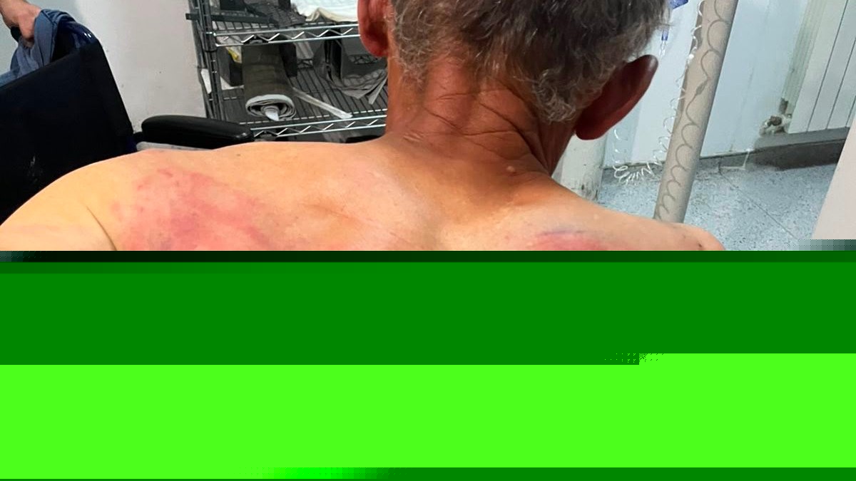 PREBIJENI SRBIN PREVEZEN U URGENTNI CENTAR U BEOGRADU! Kosovska policija vezala Nenada Raškovića za drvo i BRUTALNO GA TUKLA: Ima teške telesne povrede i psihičku traumu