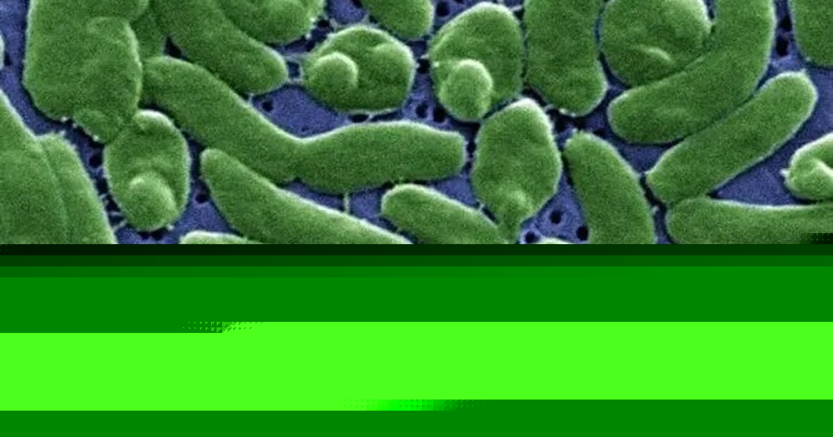 Case tracker: Here is where flesh-eating bacteria cases have been reported in the US
