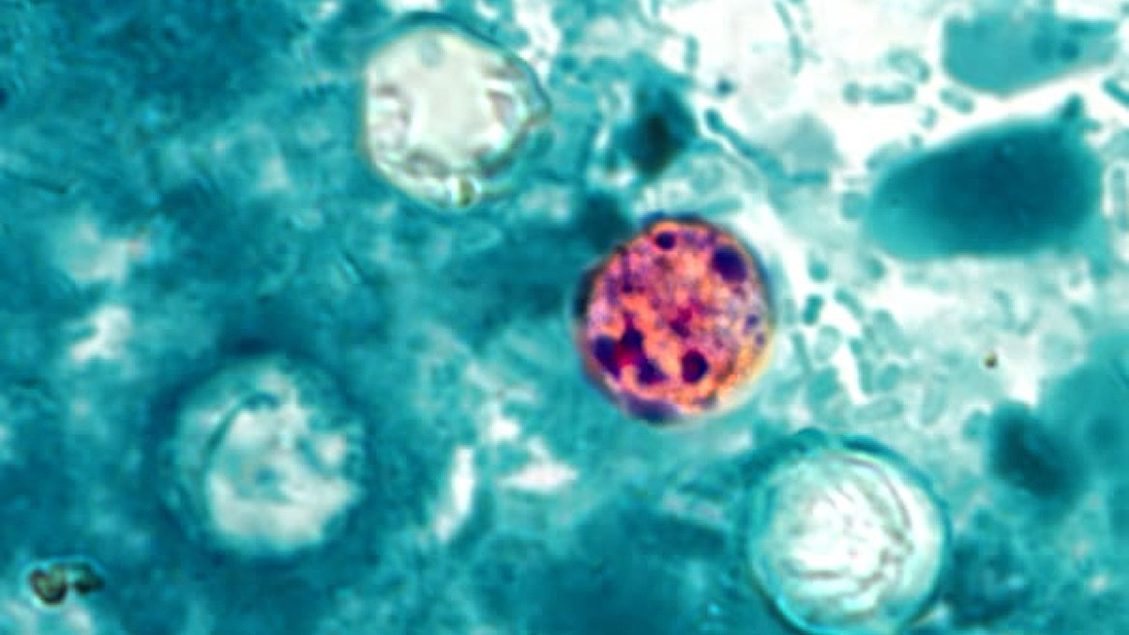 Two Deaths in Michigan Connected to Cyclospora Outbreak