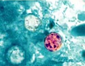 Four Local Cyclospora Cases Reported