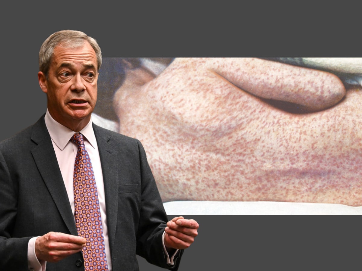 Bad news for vaccine sceptic Farage as measles returns to US