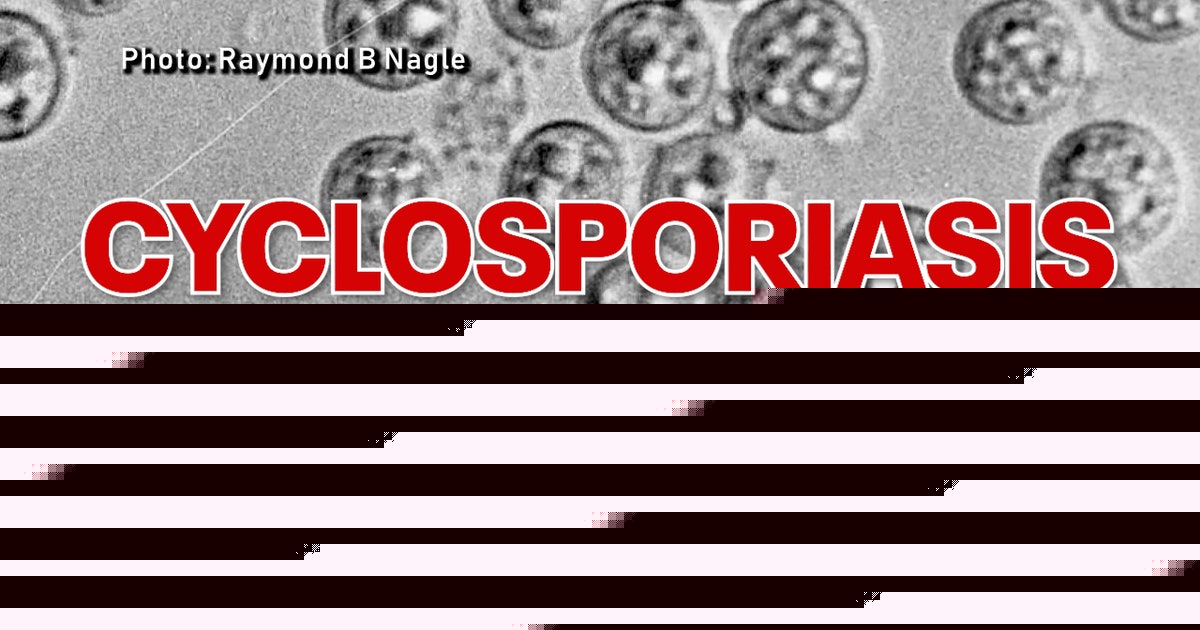 Cyclosporiasis in NYC tops 440 cases as health department investigates