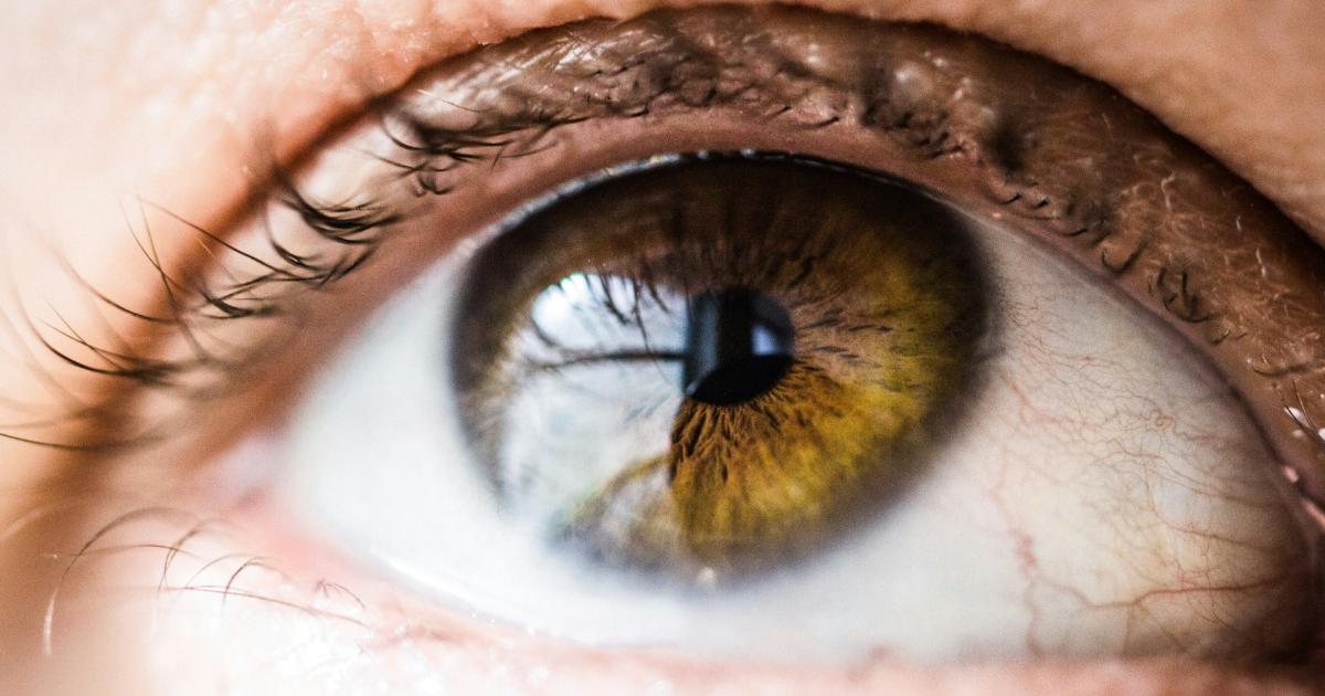Specsavers launches new service to tackle dry eyes
