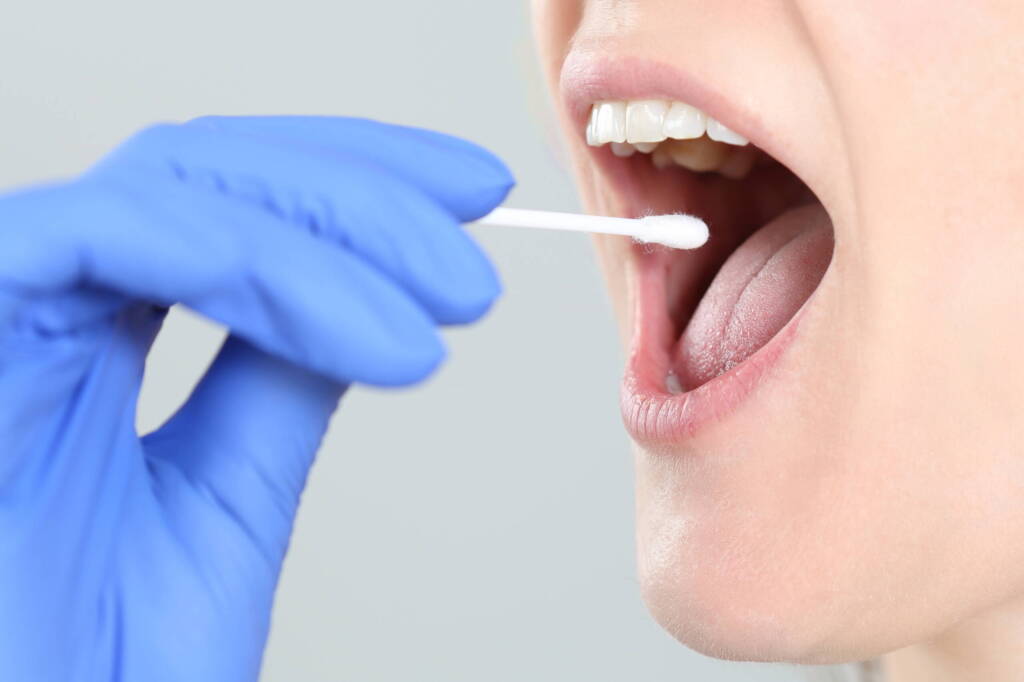 In situ polymerising bioadhesive for oral mucosal wounds