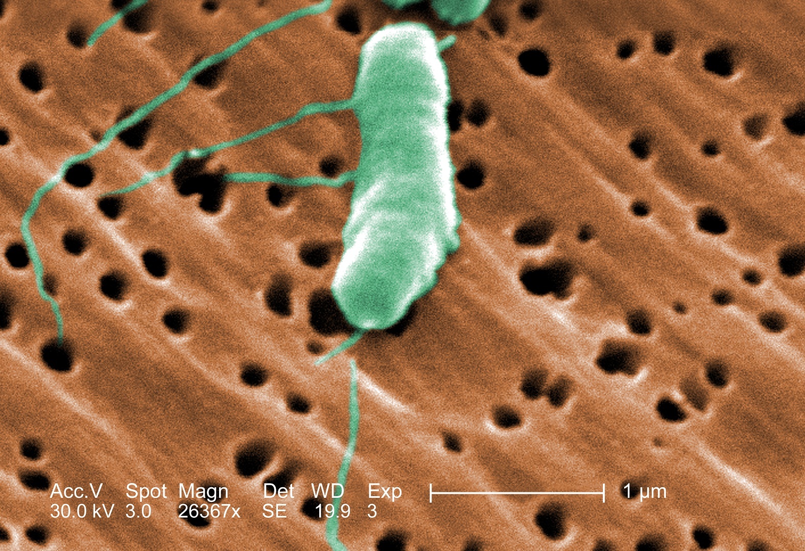 Louisiana Flesh-Eating Bacteria Deaths Reach Five As Cases Outpace 10-Year Average