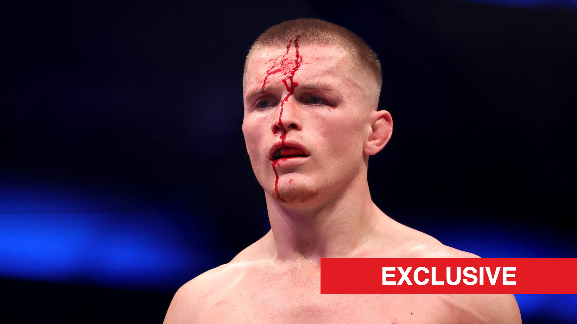Paul Hughes feared career was over after horror injury years before Usman Nurmagomedov title showdowns