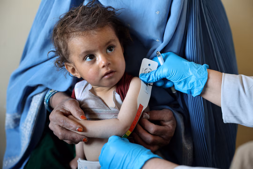 Afghanistan launches $100 million food security program as hunger crisis deepens