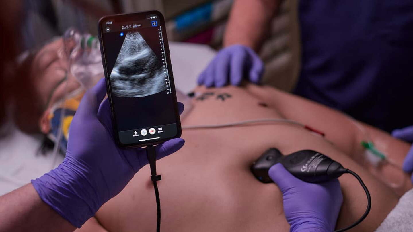 Wis. fire department equips paramedics with ultrasound for cardiac arrest calls