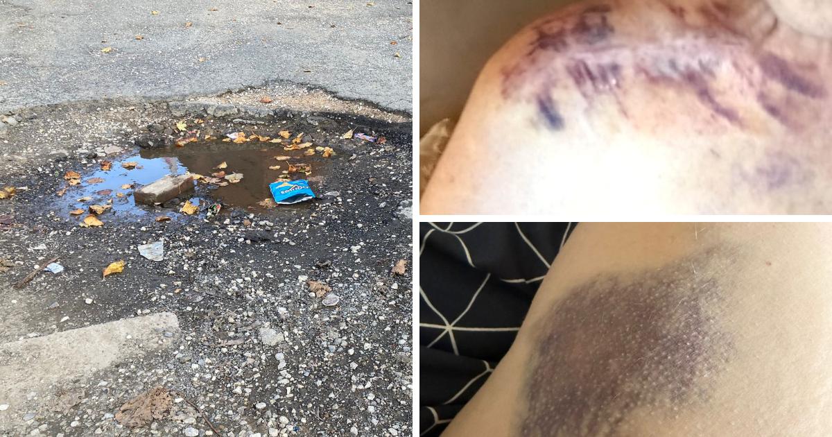 Calls for area to be resurfaced after residents injured after tripping over