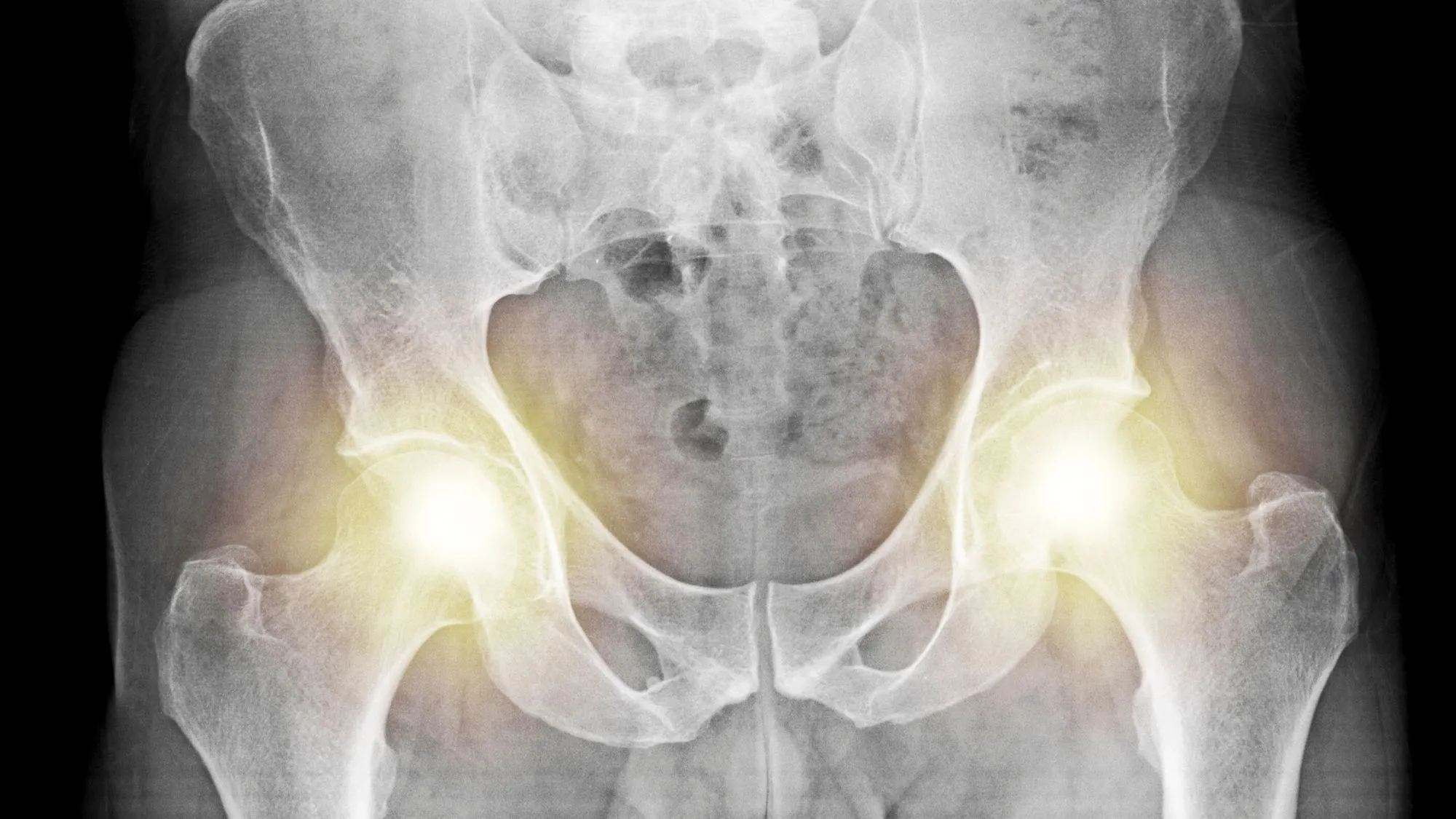 The Weird Evolutionary Reason Men and Women Have Different Pelvises