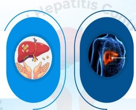 India doubles down on hepatitis prevention drive with free testing, integrated services