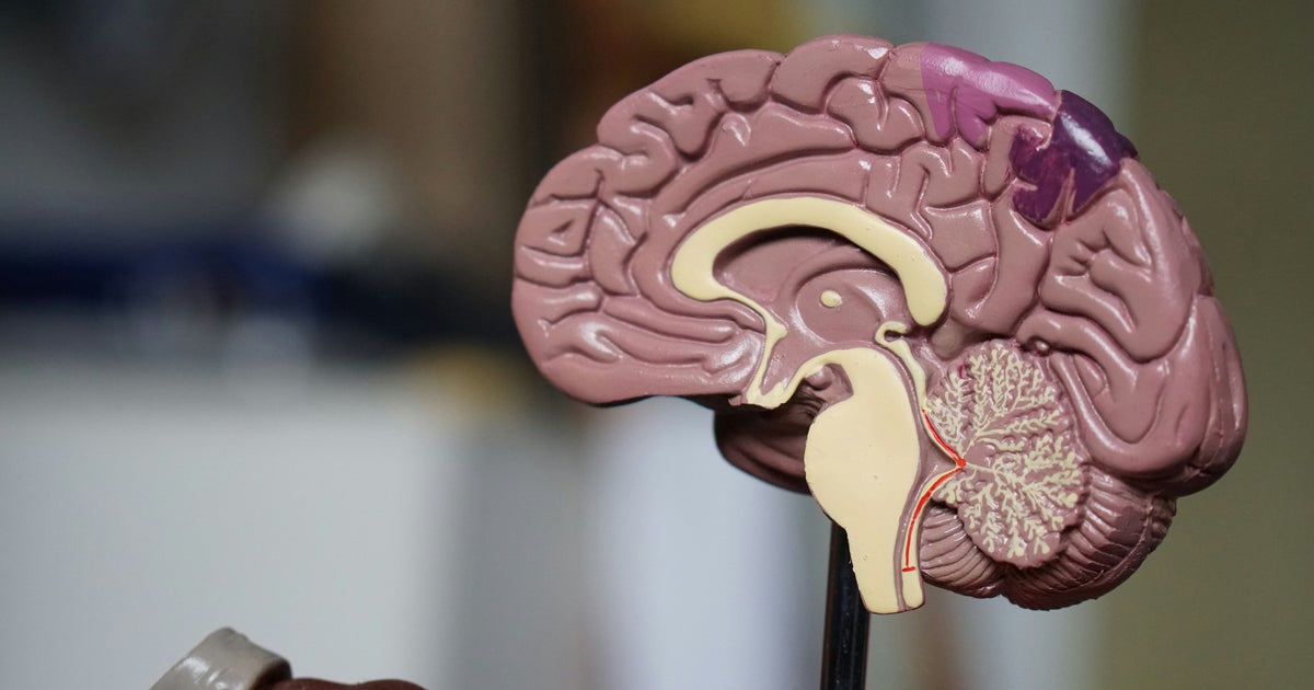 Dementia Tests May Miss Women For Years Longer Than Men