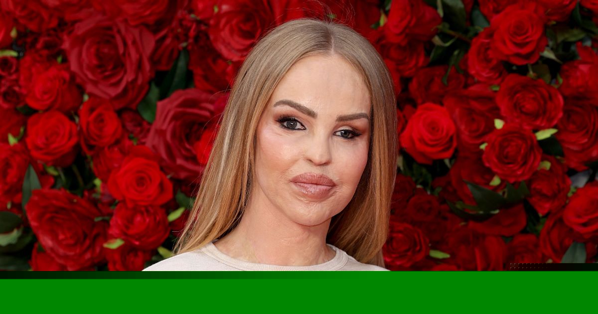 Stalker jailed over horror Katie Piper acid attack makes first bid for freedom