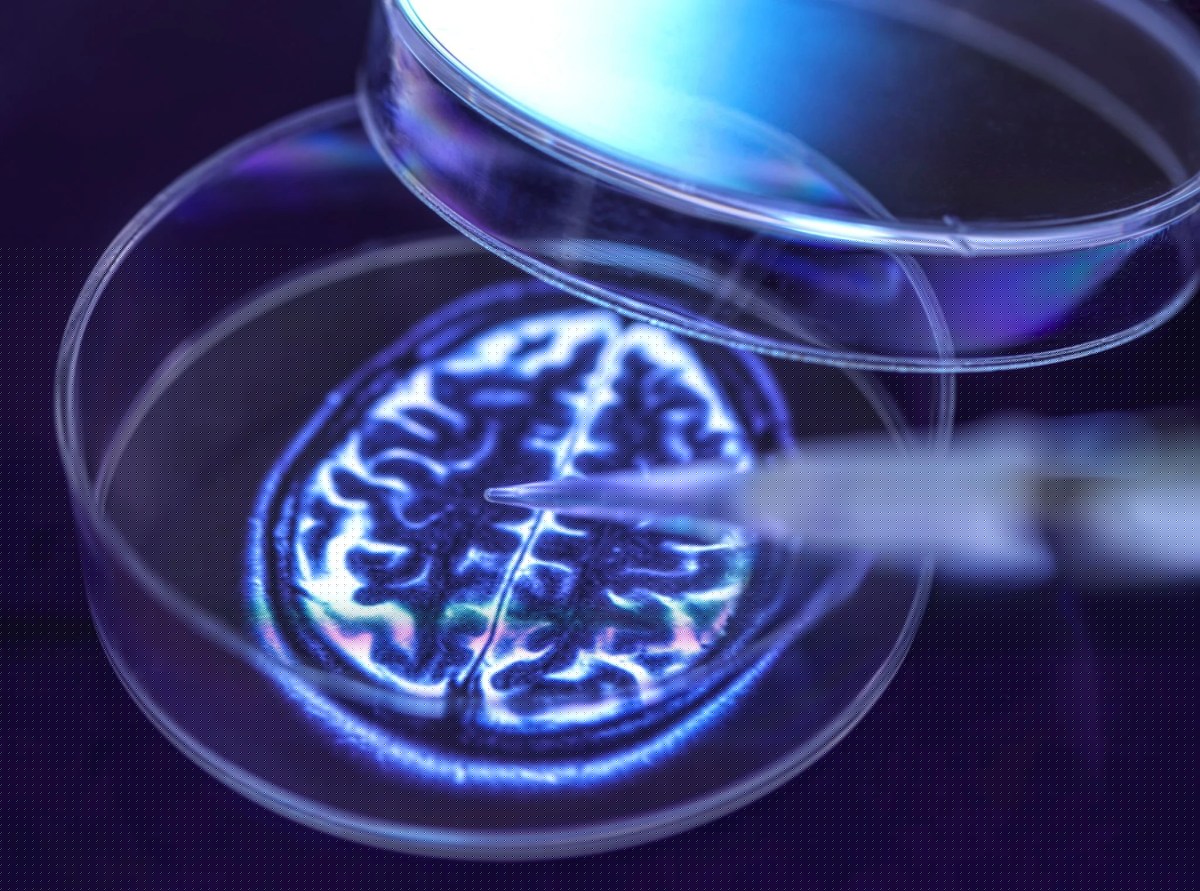 Scientists Find Brain Change That May Predict Future Dementia