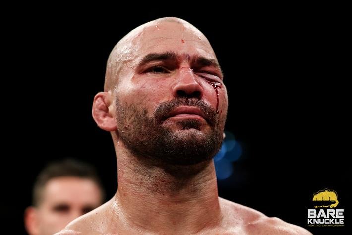 Artem Lobov Withdraws from PFL Dubai Bout with Zubaira Tukhugov After Training Injury