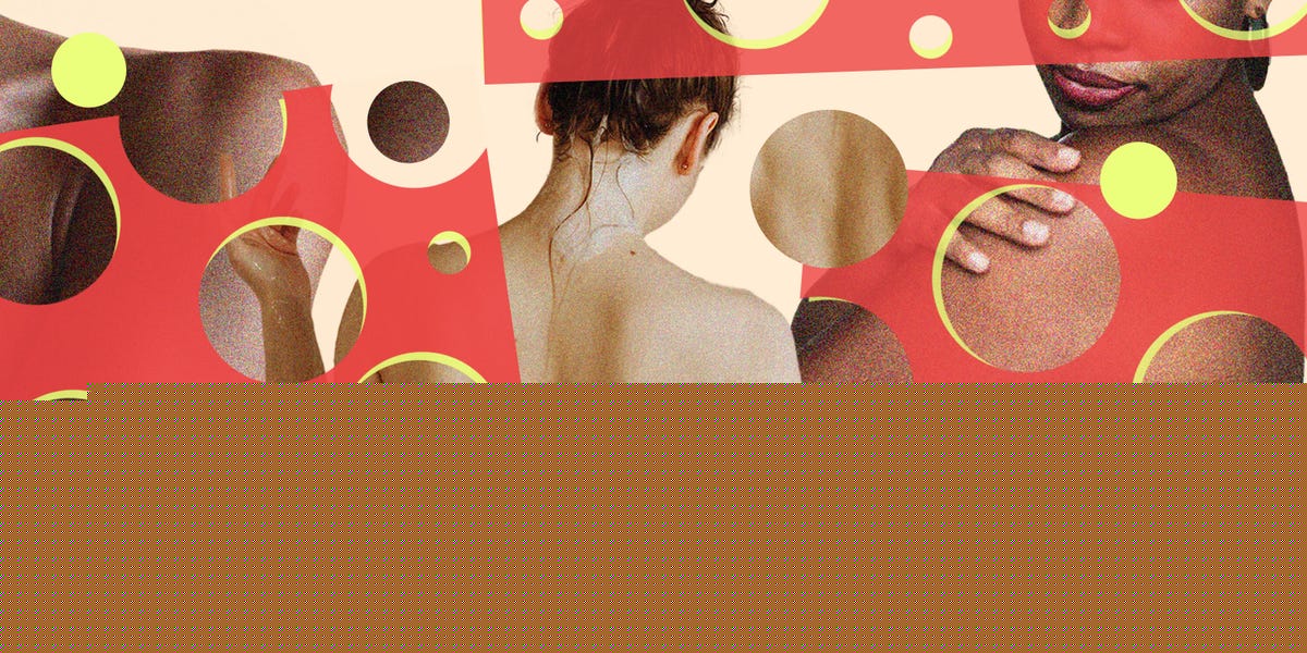 A Photo Guide To 20 Types Of Skin Bumps You Might Find On Your Body