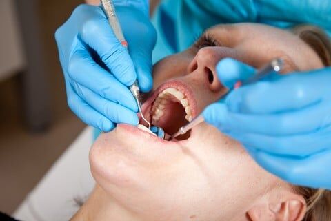 38% Silver Diamine Fluoride Helps Prevent Radiation-Related Caries, suggests study