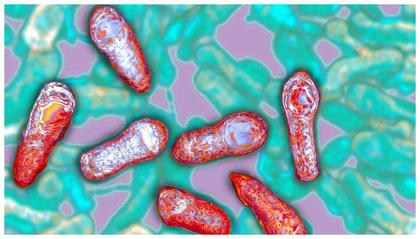 Significant botulism contamination incident in Russia results in 369 people hospitalised, 1 dead, in just 1 week