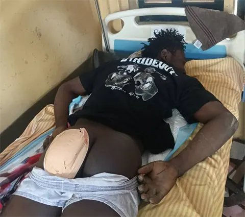 Robbery Suspect Shot, Arrested At Hospital