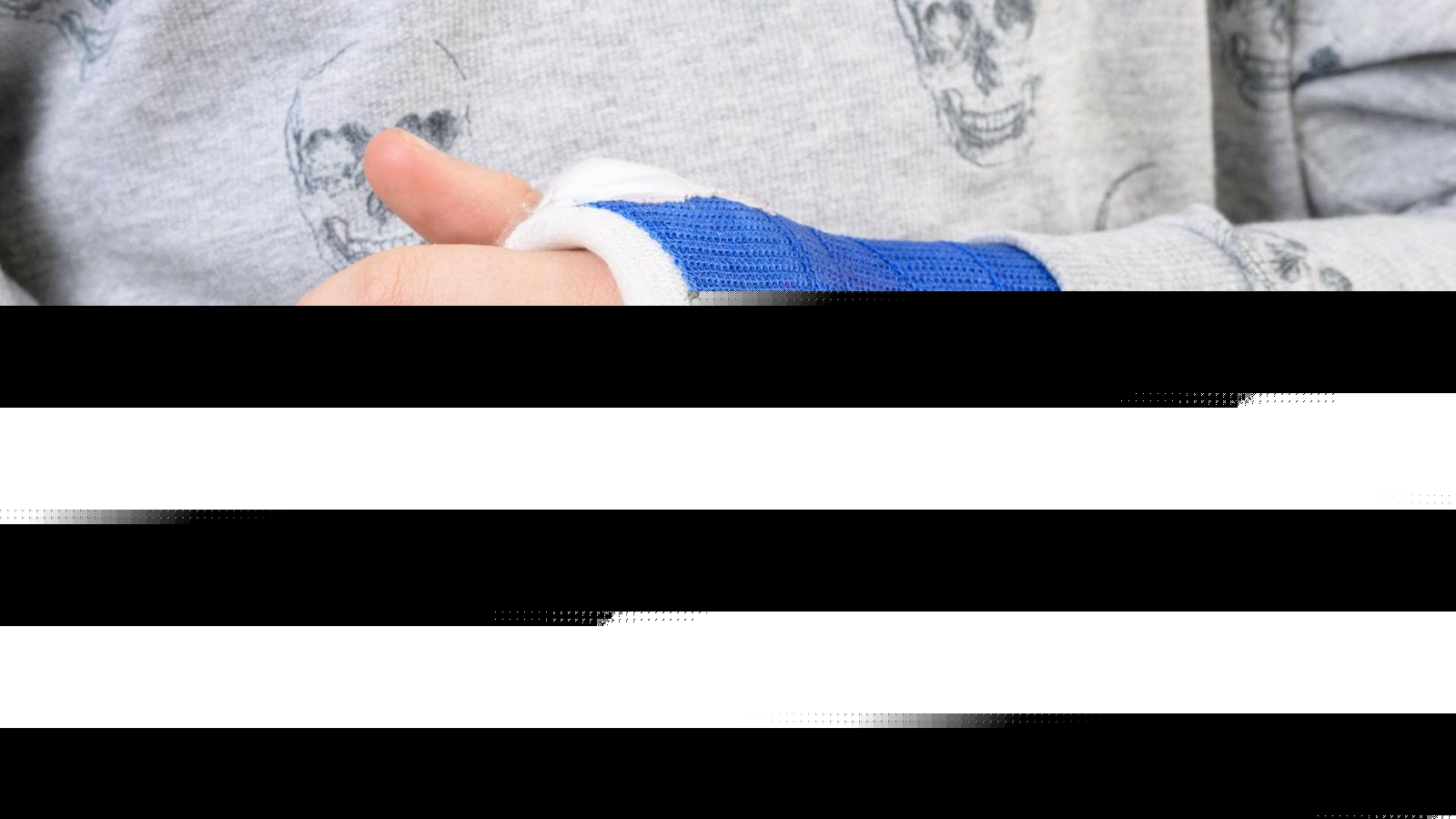 Medizinischer Durchbruch: Knochenkleber heilt Brüche in Minuten