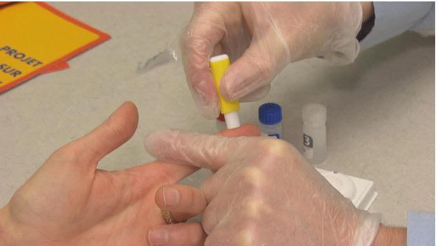 Canadian doctors form consortium to prevent potential ‘resurgence of the HIV epidemic’