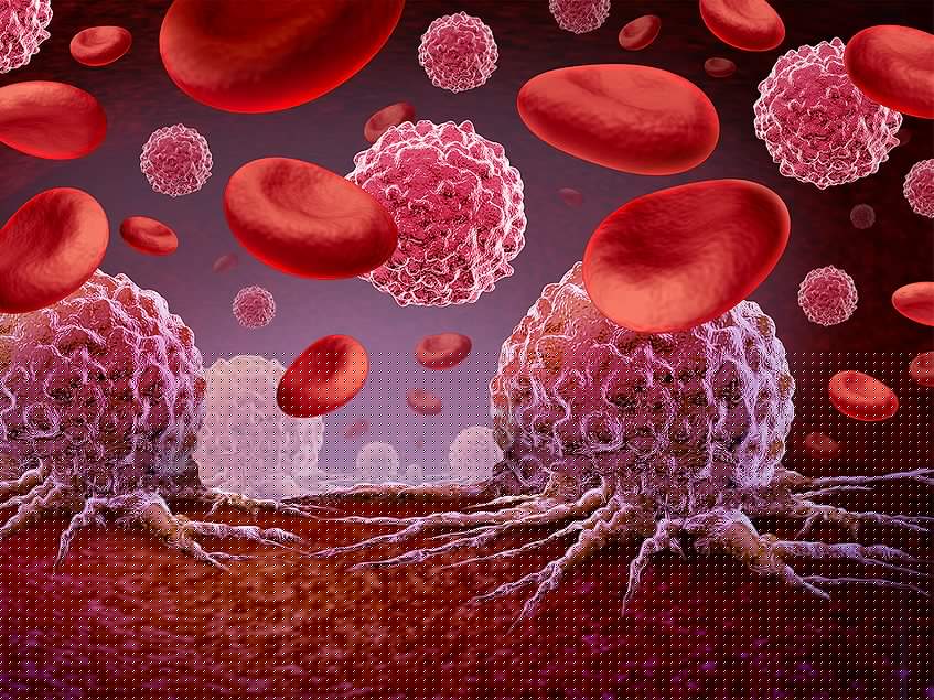 YM-1240 targets EZH2 and HDAC to suppress lymphoma