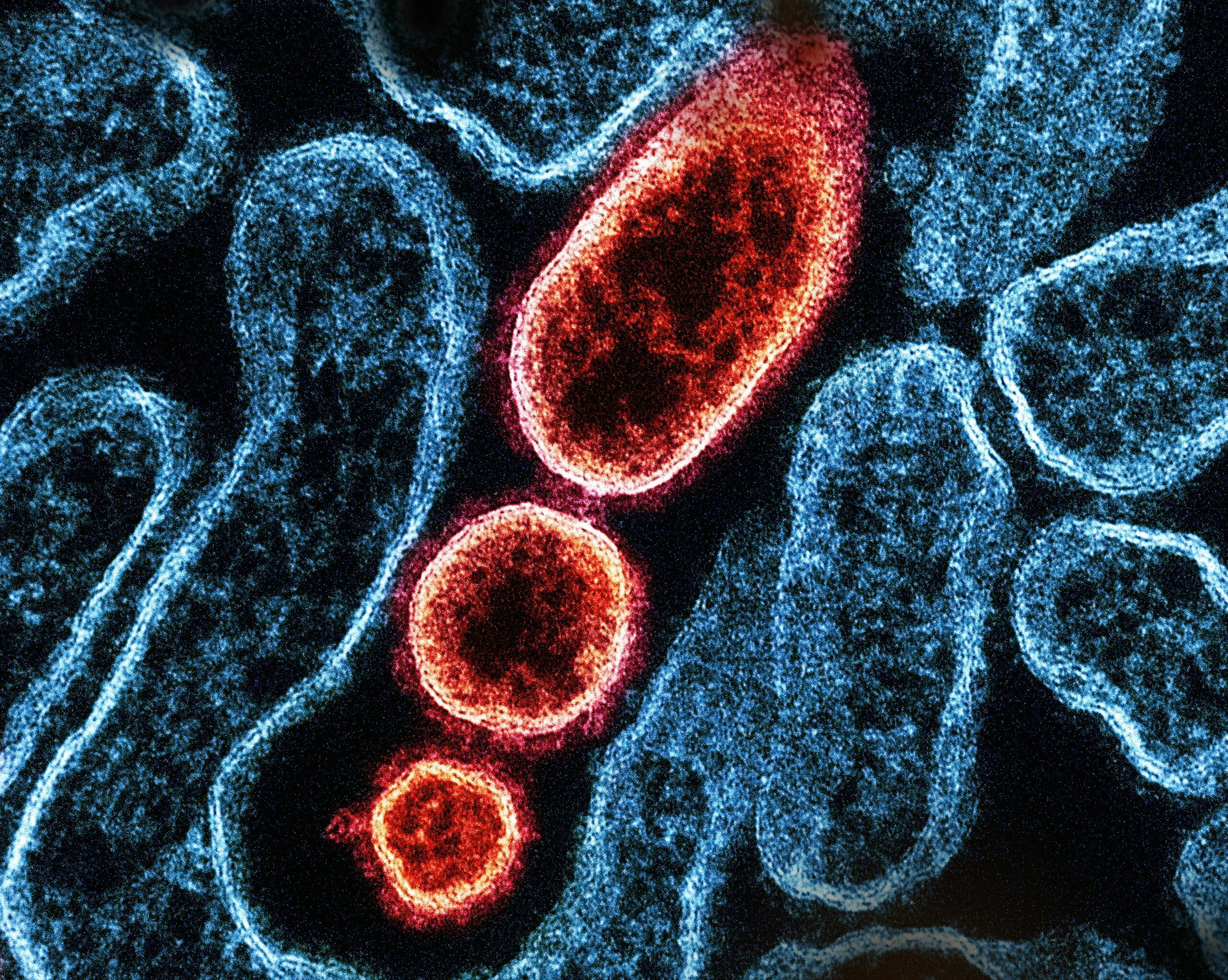 Controale amănunțite în aeroporturi din Asia după ce India anunță noi infecții cu virusul Nipah