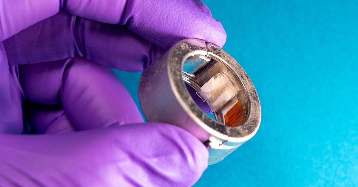 CHARM è l’anello smart che analizza il sudore per misurare i livelli di glicemia nel sangue