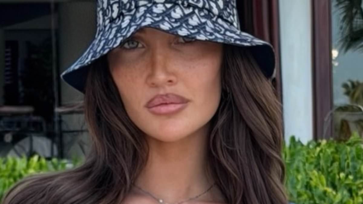 Kate Cassidy gets her Liam Payne 'angel' tattoo tribute removed from her hand 21-months after the One Direction star tragically died