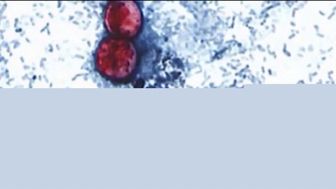 2 cyclospora deaths reported in Michigan | What you need to know